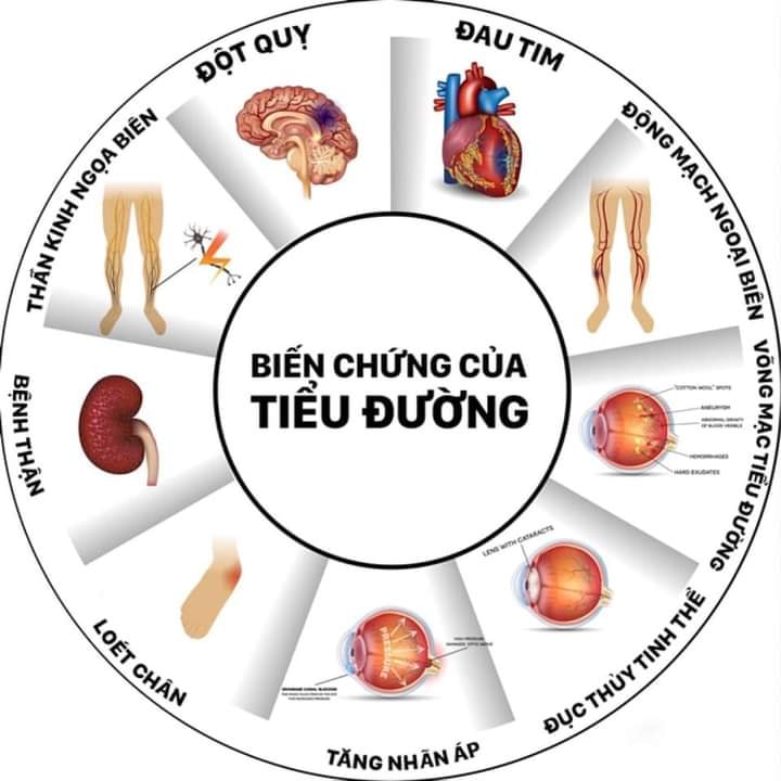 13 điều cần phải biết về TIỂU ĐƯỜNG và các BIẾN CHỨNG