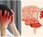Thói quen xấu và nguy cơ đột quỵ cần biết