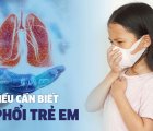 Viêm phổi ở trẻ em: Nguyên nhân, triệu chứng, chẩn đoán và điều trị