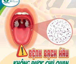 BỆNH BẠCH HẦU: NGUYÊN NHÂN, TRIỆU CHỨNG, CHẨN ĐOÁN PHÁT HIỆN SỚM