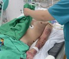 Đã có người tử vong vì nhiễm liên cầu lợn, Bộ Y tế khuyến cáo 6 cách phòng, chống bệnh